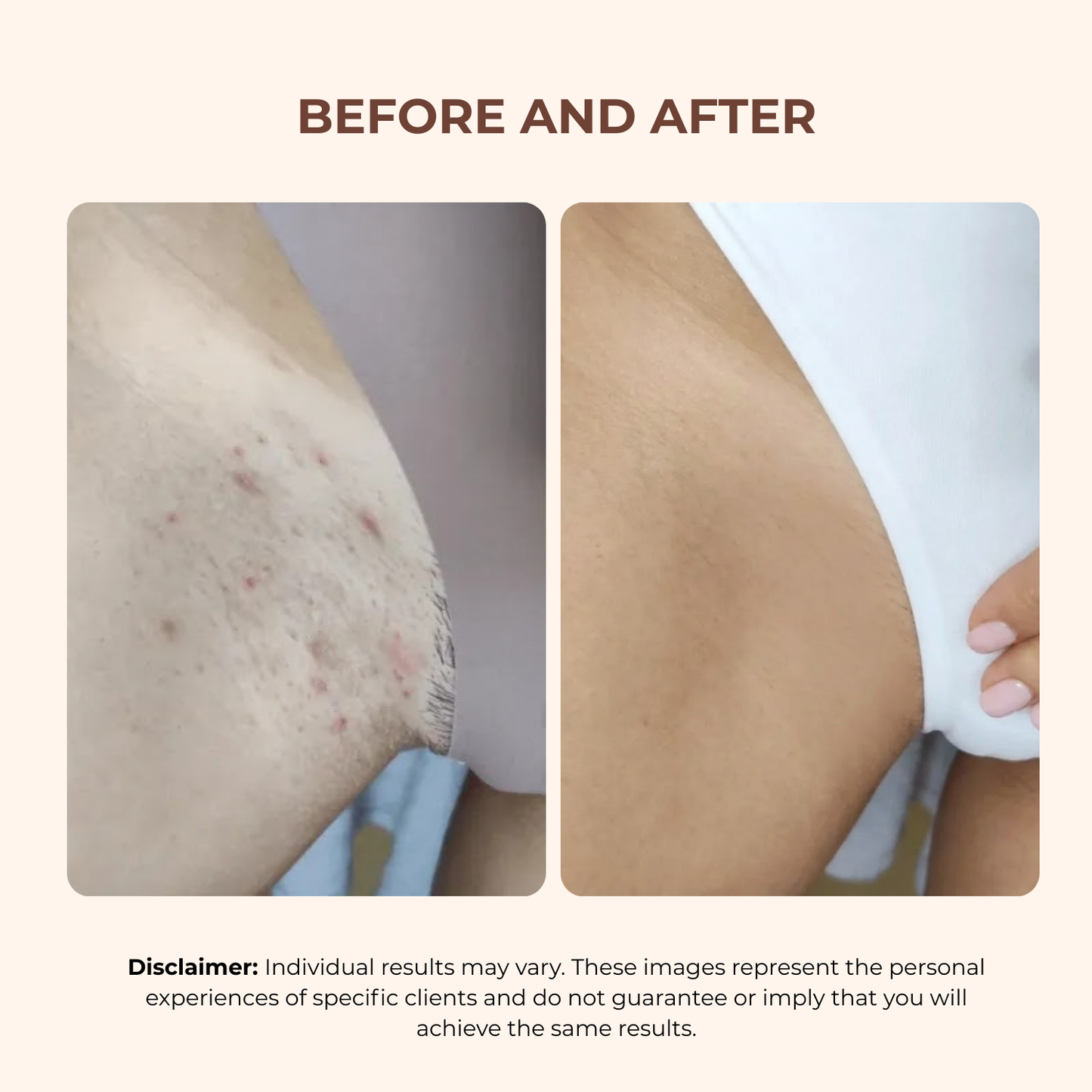 Bright Bikini Line Serum