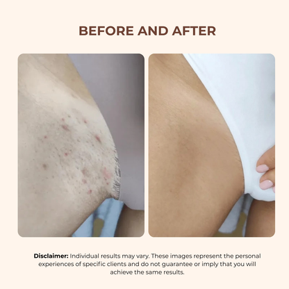 Bright Bikini Line Serum