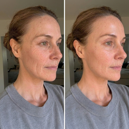 Laia · Astaxanthin for Perimenopause