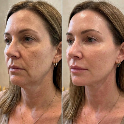 Laia · Astaxanthin for Perimenopause
